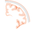 Brain Coronal Slice